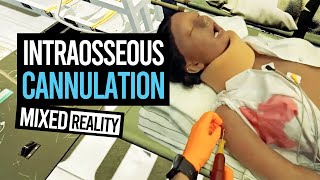 INTRAOSSEOUS IO CANNULATION WHILE IMMERSED IN MIXED REALITY ON THE VARJO XR3 [upl. by Anuahsat]