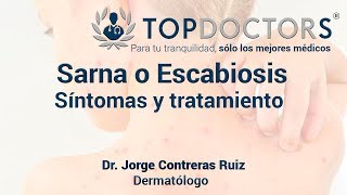 Alopecia Areata Calvicie del Estrés ¿Qué hago ¿Causas ¿Tratamiento [upl. by Petunia]