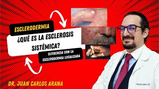 Esclerosis Sistémica y Esclerodermia localizada diferencias y características [upl. by Cigam]