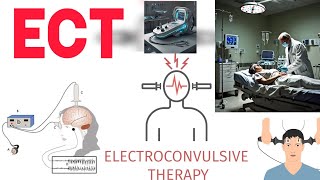 ECT  Electroconvulsive therapy  2nd year GNM nursing  Mental health nursing [upl. by Ardnu]