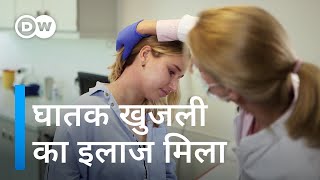 एक्जिमा के मरीजों के लिए नई उम्मीद New eczema medication has revolutionized treatment [upl. by Ralip288]