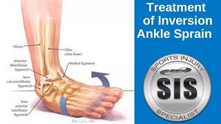 Inversion Ankle Sprain Treatment [upl. by Purdy]