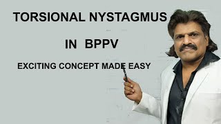 TORSIONAL NYSTAGMUS IN BPPV  EXCITING CONCEPT MADE EASY [upl. by Aenel452]