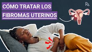 Fibromas uterinos ¿Cuáles son los síntomas y las opciones de tratamiento [upl. by Thackeray]