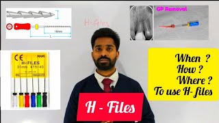 H  Files in Endodontics [upl. by Gamali]