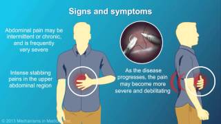 Chronic Pancreatitis [upl. by Eillehs]