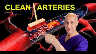 The Best Foods to Clean Arteries amp Reverse Plaque Prevent Heart Attack amp Stroke Dr Mandell [upl. by Eelrefinnej528]