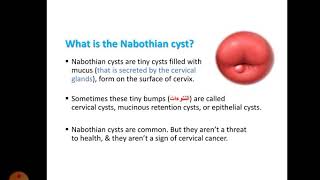 Nabothian cyst part 3 [upl. by Barbaresi]