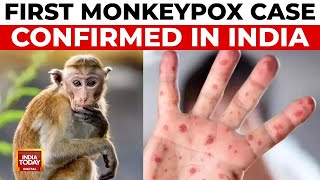 India Reports First Confirmed Monkeypox Case NonEmergency Variant Detected [upl. by Daigle723]