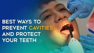 quotYour Teeth’s Worst Enemy How to Beat Cavities for Goodquot dentist caries teeth [upl. by Atnwahs]