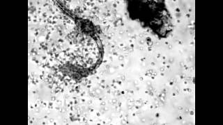 MicroRamziology  Eosinophils attacking a parasite [upl. by Faith]