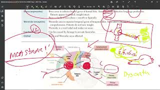 42 Aphasia amp Dysarthria [upl. by Mable40]