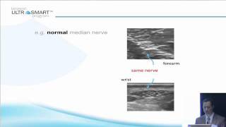 Terasons MSK Ultrasound Basics with Dr Visco Part 5 of 8 [upl. by Irved]