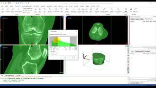 How to Perform Thresholding in Mimics  Mimics Innovation Suite  Materialise Medical [upl. by Paolo]