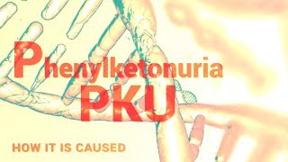 Phenylketonuria  PKU  Mental Retardation  Phenylalanine Hydroxylase [upl. by Nirrac290]