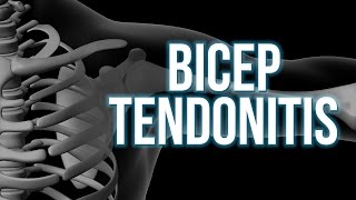 Bicep Tendonitis 3 steps to start the healing [upl. by Tehr188]