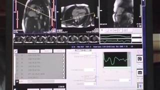 How to perform a cardiac MRI study [upl. by Ahens]