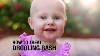 How to treat Drooling Rash [upl. by Friedman]