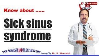 Sick sinus syndrome SSS  Causes Diagnosis Symptoms Treatment Prognosis [upl. by Evol]