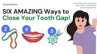 SIX AMAZING WAYS to Get Rid of that Tooth Gap [upl. by Airasor]