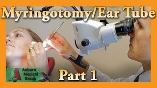 Myringotomy amp Ear Tube Part 1 Feat Dr Tim Fife  Myringotomy  Auburn Medical Group [upl. by Yaresed]