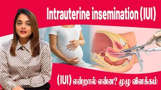 Intrauterine Insemination IUI [upl. by Sanson]