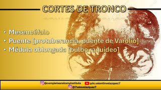 NEUROANATOMÍA  CORTES DE TRONCO Mesencéfalo puente médula oblongada bulbo raquídeo [upl. by Ayyidas21]