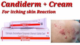 Candiderma  Cream  Candiderma Plus Cream  Candiderma  Cream Use Benefit Dosage Review in hindi [upl. by Acimaj]