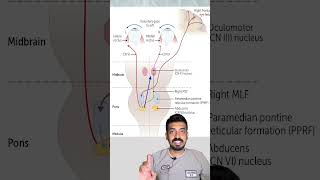 Internuclear Ophthalmoplegia concept explained in 3minutes [upl. by Costin]