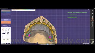 Denture set up in Exocad with Partial modular [upl. by Orelee]