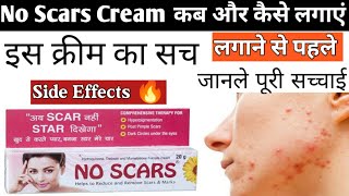 No Scars Cream कब लगाए और कब लगाना बंद करे No Scars क्रीम Uses  No Scars Cream side effects [upl. by Eanaj]