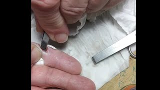 Satisfying Splinter Removal l 34 [upl. by Zetra]