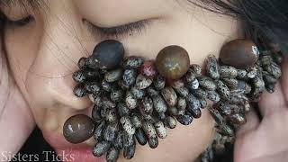 Ticks are all over my face [upl. by Vada]