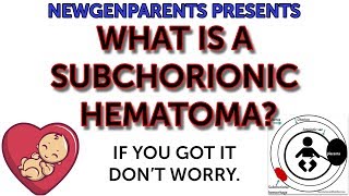 What’s a subchorionic hematoma [upl. by Solley]