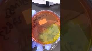 Burkholderia cepacia B cepacia  Microbiology [upl. by Anahgem]