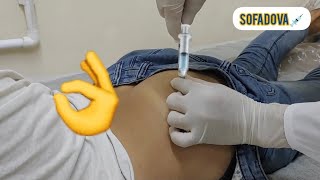 intramuscular IM shot an injection into the gluteal muscle [upl. by Aurel]