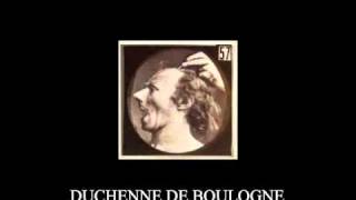 DUCHENNE DE BOULOGNE [upl. by Asseral]