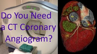 Do you need a CT coronary angiogram [upl. by Ardnohsed468]