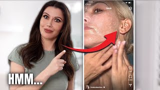 Kim Ks Face Lift Scars Hers VS Mine… [upl. by Wappes]