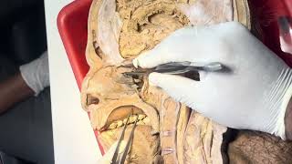 Lateral wall of nose dissection and sagittal section of head and neck [upl. by Eiryk578]