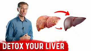 A Surprising Way To Cleanse Fatty Liver – Dr Berg On Liver Detoxification [upl. by Llenra108]