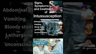 Intussusception A Comprehensive Review of signs symptoms amp Treatment DrSaima khan shorts [upl. by Rundgren]