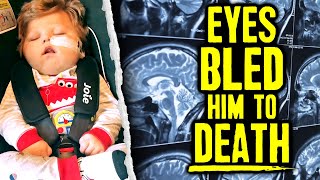 Infant’s Brain Torn amp Eyes Bled Him To Death [upl. by Odilia]