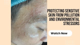 Protecting Sensitive Skin from Pollution and Environmental Stressors [upl. by Ilan]