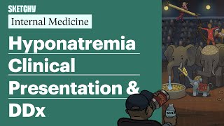 Hyponatremia Clinical Presentation amp DDx Internal Medicine  Sketchy Medical [upl. by Ailgna432]