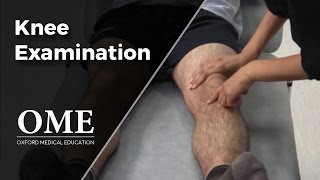 Knee Examination  Orthopaedics [upl. by Letitia926]