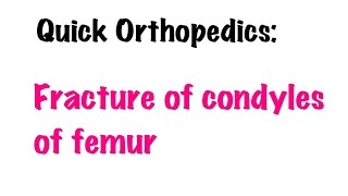 QUICK ORTHOPEDICS Fracture of condyles of Femur [upl. by Nuj]