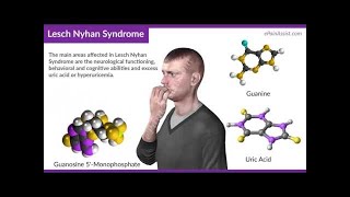 INBORN ERRORS OF NUCLEIC ACID METABOLISM  LESCH–NYHAN SYNDROME [upl. by Gerry]