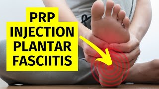 Plantar Fasciitis PRP Injection [upl. by Sirahs]