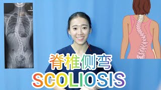 【PHYSIOTHERAPY  SCOLIOSIS】脊椎侧弯 [upl. by Maurine]